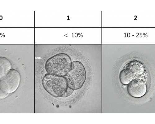 北京哪家代孕公司好,北京协和做试管多少钱_北京协和试管需要多少钱费用
