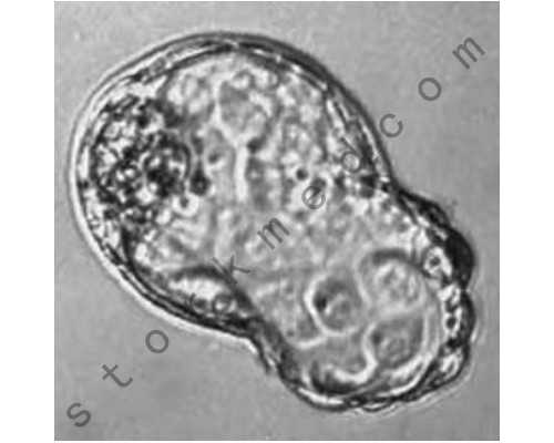 北京代孕包女孩,试管婴儿技术点赞北京家圆