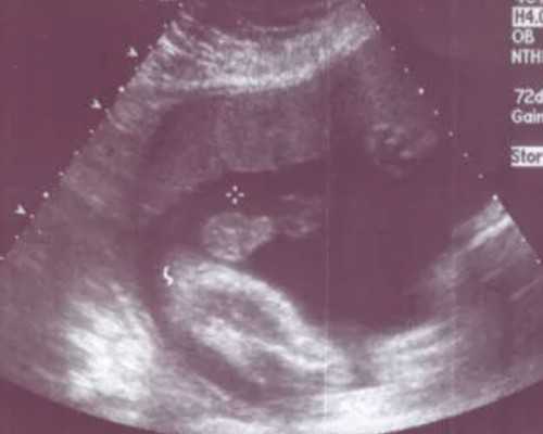 产后恶露颜色怎样算正常，产后恶露颜色变化