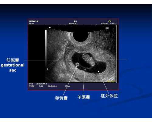 北京供卵试管成功,2024北京协和医院供卵试管多少钱？附北京供卵试管费用一览