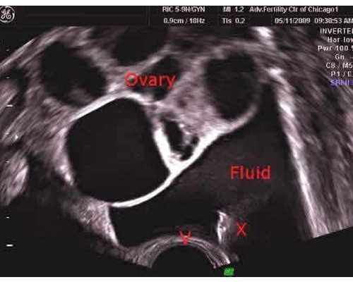 孕期孕妇体重多少算正常范围