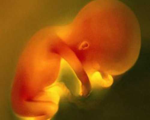 产后同房需要避孕吗，产后同房需要避孕吗