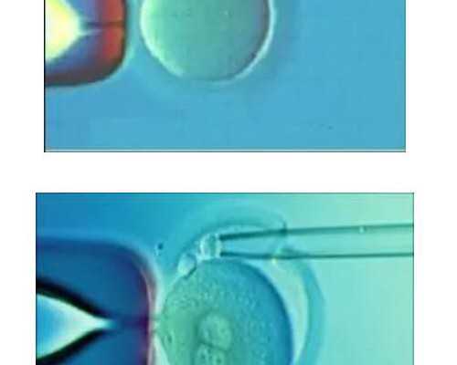 郑州省妇幼做试管婴儿多少钱？哪些因素会影响试管婴儿收费？