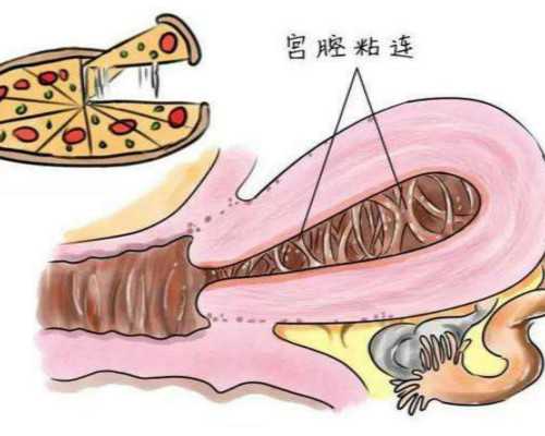 北京试管婴儿医院排名比较好的医院？北京试管婴儿医院排行？