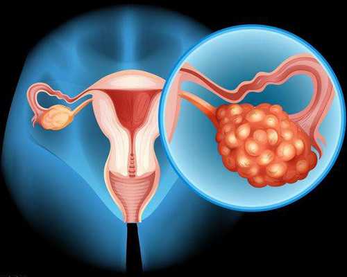 北京哪里做代怀最好|在金华供卵试管要多少钱？金华供卵试管要多久？