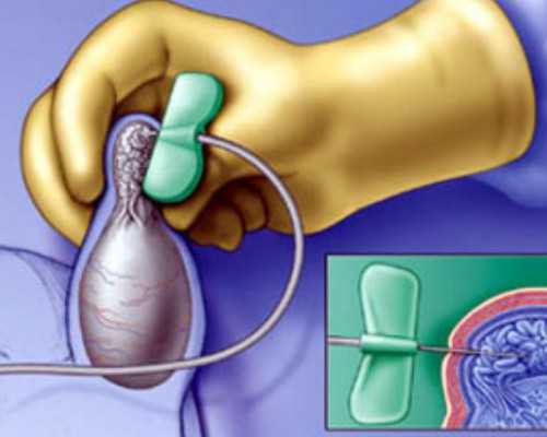 北京代孕有哪些条件|北京供卵试管婴儿医院成功率排名，附试管助孕医院名单