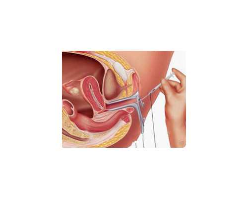 北京供卵自怀机构,北京供卵代生，北京代怀包成功
