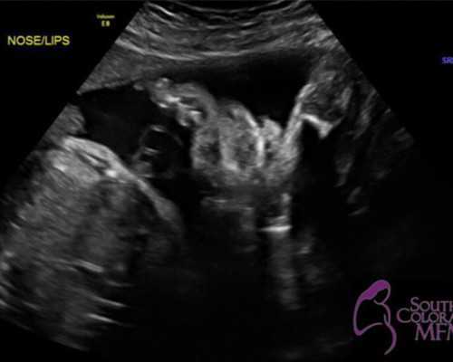 北京私立供卵试管医院,2024北京供卵医院试管婴儿多少钱？附北京供卵5强试管医