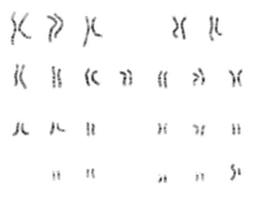 北京代生医院怎么样,北京试管第三代一般多少钱北京三医院做三代试管多少钱