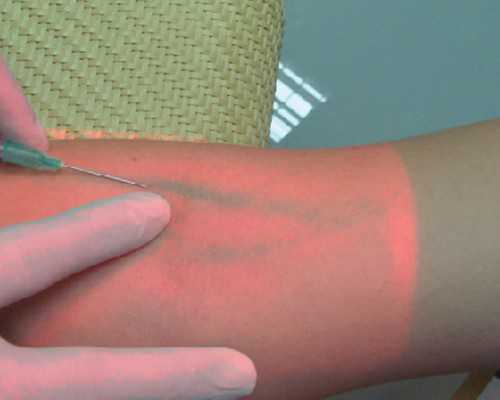 月经期怎么吃螃蟹